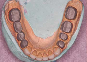 Importance of Coping & Bisque Trial