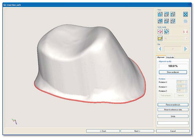 Role of CAD CAM in Prosthetic Dentistry