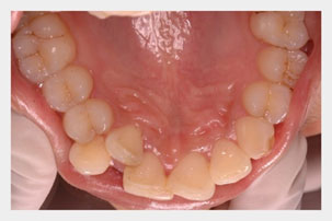 10 Views of Dental Photography