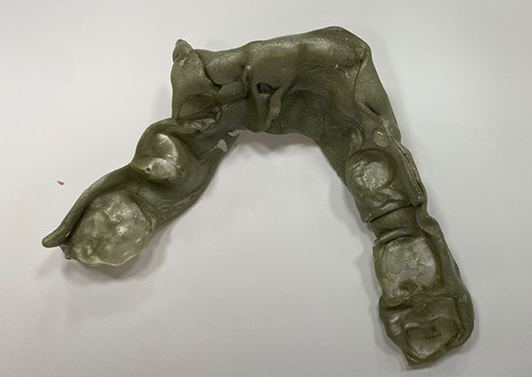 Smile Design and Treatment Planning