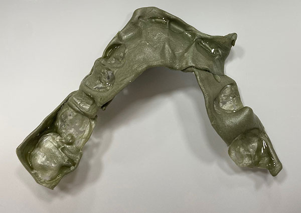 Smile Design and Treatment Planning