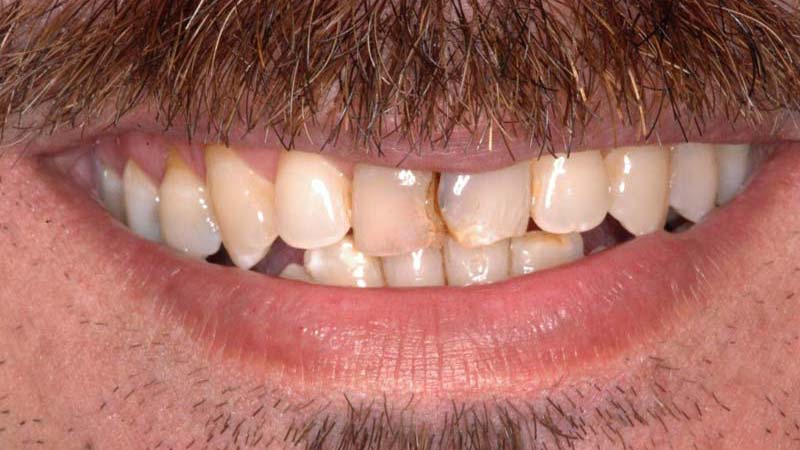 Smile Analysis Workshop